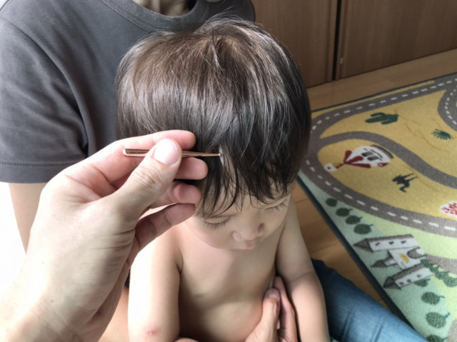 かんむしの改善のために小児鍼をする子供